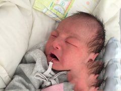 年轻夫妇染色体异常试管得子